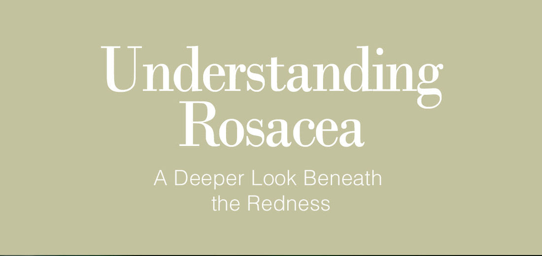Understanding Rosacea: A Deeper Look Beneath the Redness
